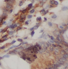 PRKCQ antibody|PRKCQ抗体