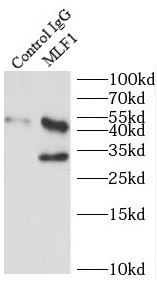 LSS antibody|LSS抗体 FNab04881