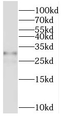 PIP4P1 antibody|PIP4P1抗体