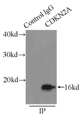 NIP7 antibody|NIP7抗体