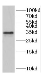 CCNG1 antibody|CCNG1抗体