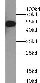 TRIM11 antibody|TRIM11抗体