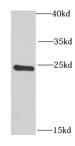 RAB17 antibody|RAB17抗体