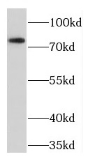 TGFBRAP1 antibody|TGFBRAP1抗体