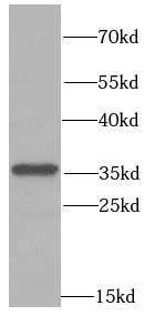 PPP4C antibody|PPP4C抗体