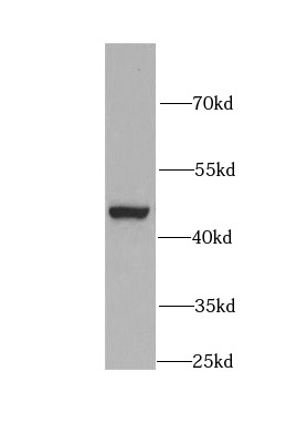 KRT19 antibody|KRT19抗体 FNab022