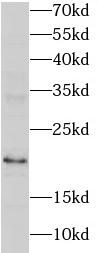 RNASEH2C antibody|RNASEH2C抗体