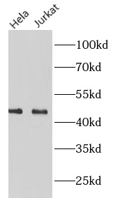 MICA antibody|MICA抗体 FNab10964
