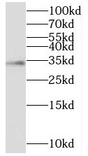 IGFBP2 antibody|IGFBP2抗体 FNab1