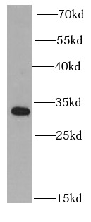 PSME2 antibody|PSME2抗体