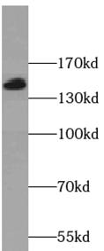 SKIC3 antibody|SKIC3抗体