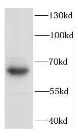 DEUP1 antibody|DEUP1抗体