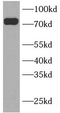 INPP5B antibody|INPP5B抗体