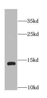 COTL1 antibody|COTL1抗体 FNab018