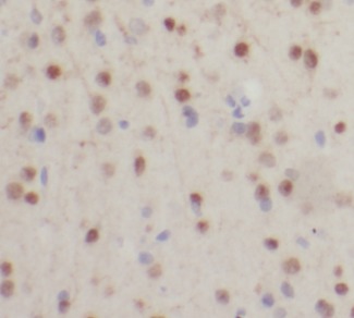 SMN1 antibody|SMN1抗体 FNab08030