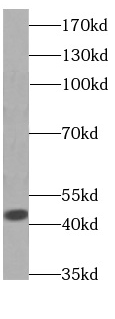 GOT1 antibody|GOT1抗体 FNab03568