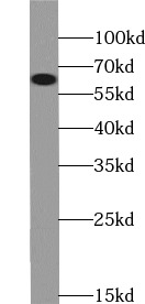 PRKCI antibody|PRKCI抗体
