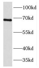 FOXJ3 antibody|FOXJ3抗体 FNab031