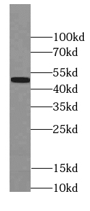 PAX1-Specific antibody|PAX1抗体