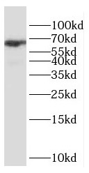 ESX1 antibody|ESX1抗体