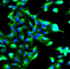 ANXA2 antibody|ANXA2抗体 FNab004