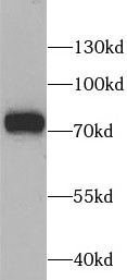 SLC25A13 antibody|SLC25A13抗体