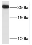 TAF1L antibody|TAF1L抗体