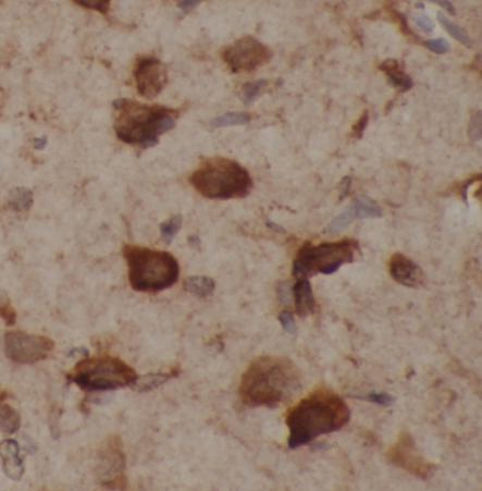 SNCA antibody|SNCA抗体 FNab09891