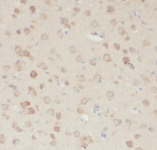 PDE7B antibody|PDE7B抗体