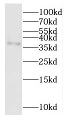 OGN antibody|OGN抗体