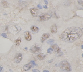 TNFAIP3 antibody|TNFAIP3抗体 FNa