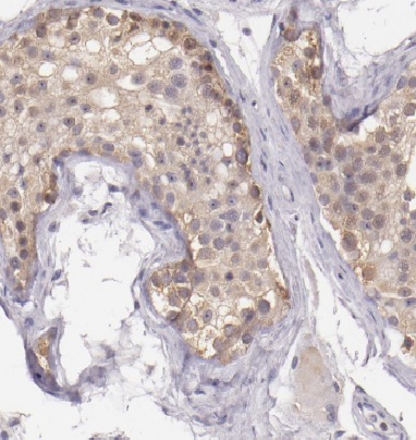 DDR1 antibody|DDR1抗体 FNab02291