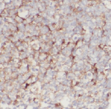 CD2 antibody|CD2抗体 FNab01438