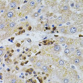 BEST1 antibody|BEST1抗体 FNab008