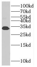 SLC25A45 antibody|SLC25A45抗体
