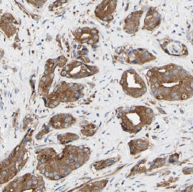 COG3 antibody|COG3抗体