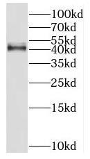 HSD11B2 antibody|HSD11B2抗体