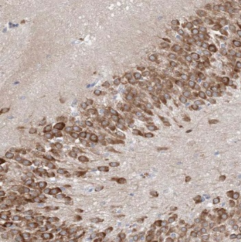 RARB antibody|RARB抗体