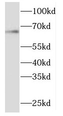 ME1 antibody|ME1抗体