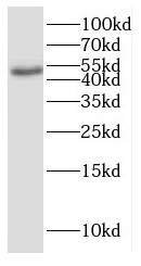 GHRHR antibody|GHRHR抗体