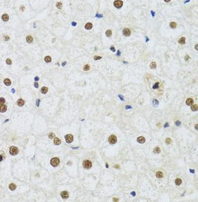 DDB1 antibody|DDB1抗体 FNab02284