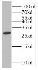 MAGEH1 antibody|MAGEH1抗体