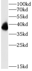 PRPH2 antibody|PRPH2抗体