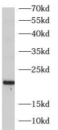ARL3 antibody|ARL3抗体