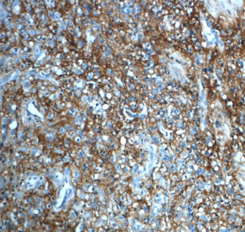 ITIH3 antibody|ITIH3抗体