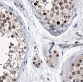 PAGE2 antibody|PAGE2抗体