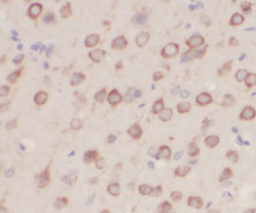 NF2 antibody|NF2抗体 FNab05685