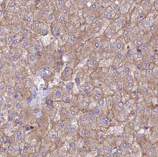 SERINC1 antibody|SERINC1抗体