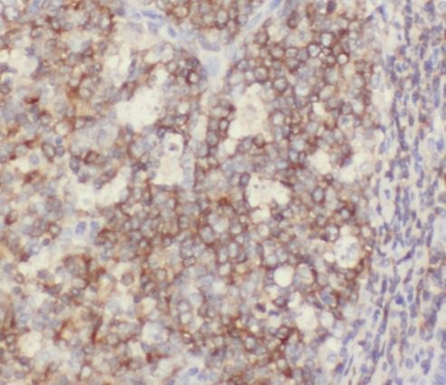 CD6 antibody|CD6抗体