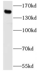 SBNO1 antibody|SBNO1抗体